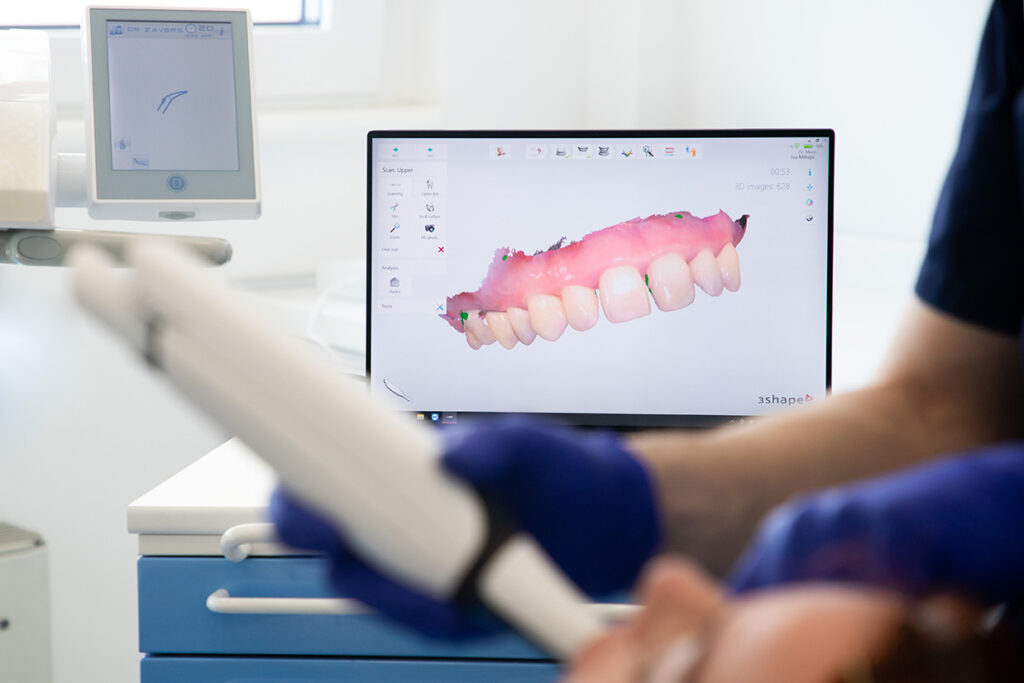 3D intraoral scanner capturing digital scans of a patient's teeth at Trust Dental Surgery